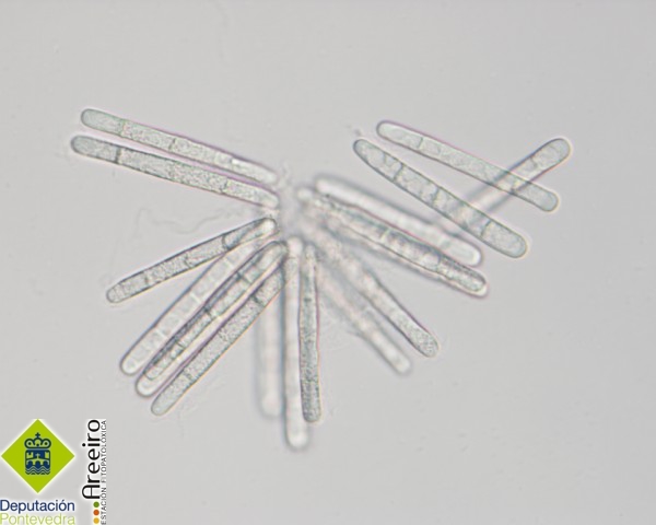 Cylindrocladium Ilicicola - Conidias caracteristicas de C. Ilicicola.jpg